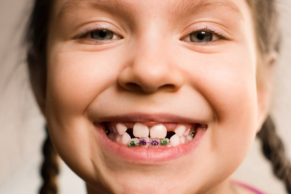 Детский ортодонт: идеальная улыбка на всю жизнь