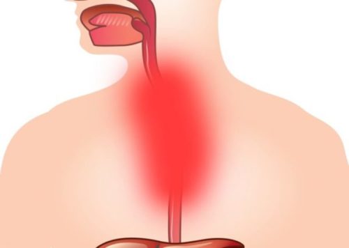 Воспаление горла и пищевода