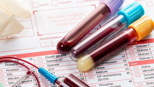 Анализы крови при панкреатите – норма, отклонения, расшифровка