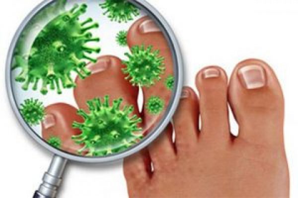 Новый прорыв в лечении грибковой инфекции кожи и ногтей: знакомьтесь с многофункциональным «Дерматизон»!